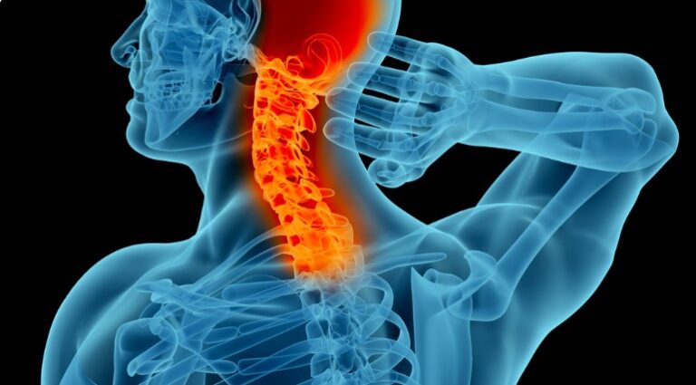 stretches to alleviate neck pain while sleeping